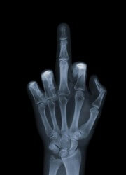 x ray orta parmak